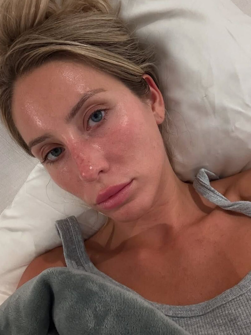 Alix Earle after using Reale Actives (Before and after)