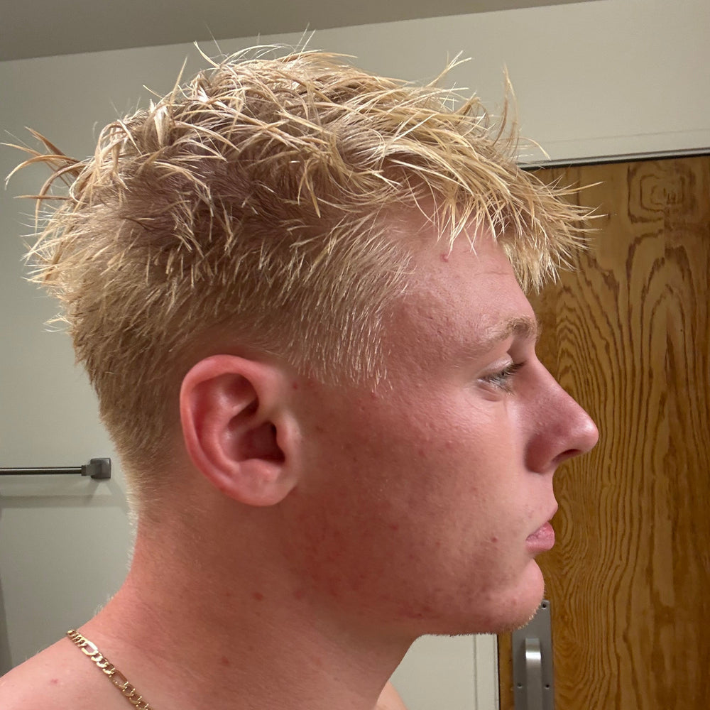 After